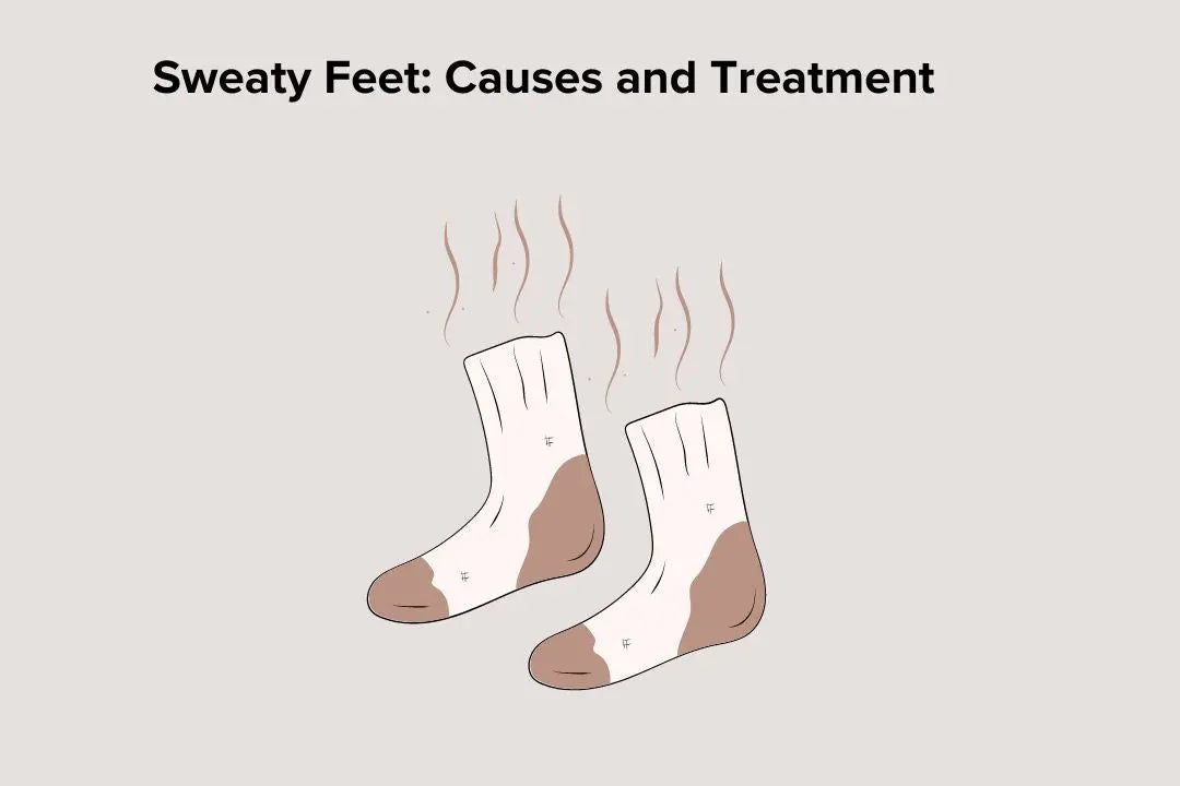 Sweaty-Feet-Causes-and-Treatment Q for Quinn™